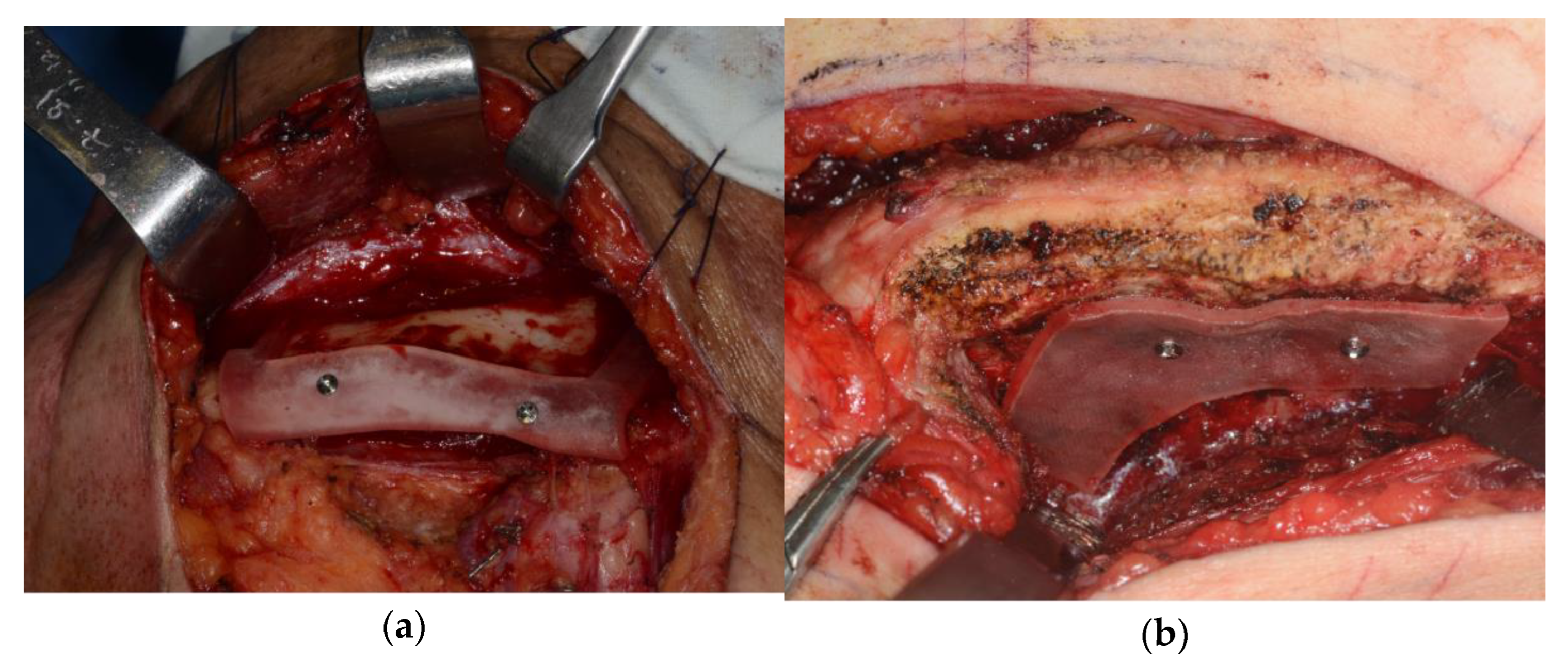 Applsci 13 02855 g006 Applsci 13 02855 g006