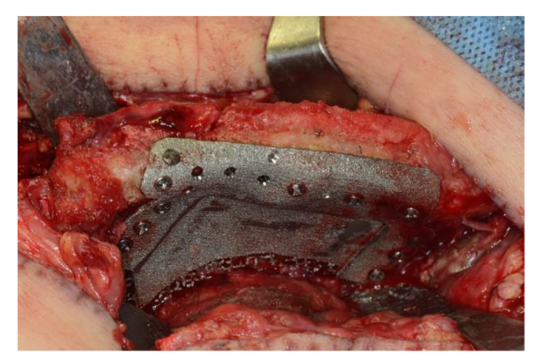 Applsci 13 02855 g008 Applsci 13 02855 g008