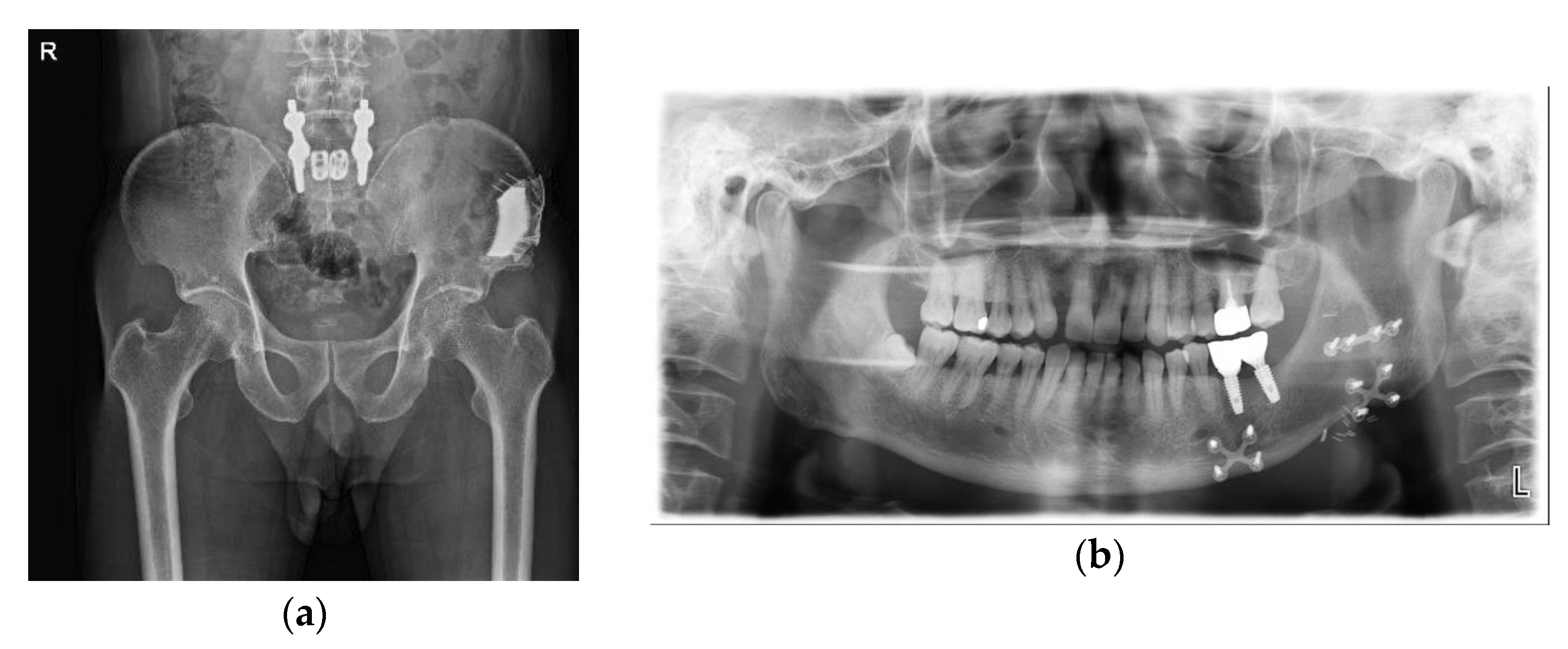Applsci 13 02855 g009 Applsci 13 02855 g009