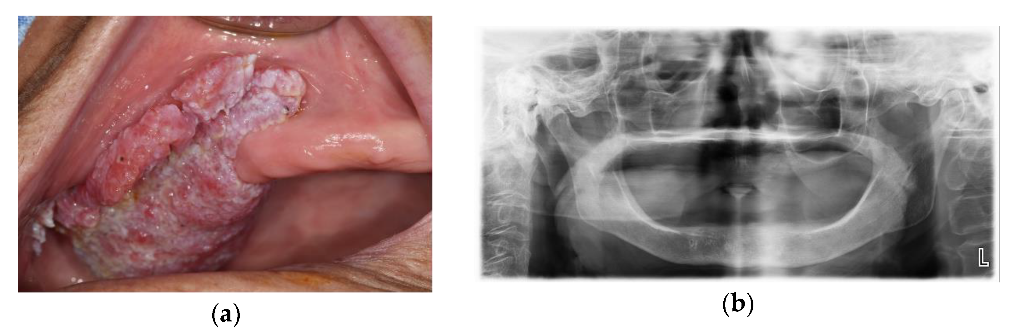 Applsci 13 02855 g010 Applsci 13 02855 g010