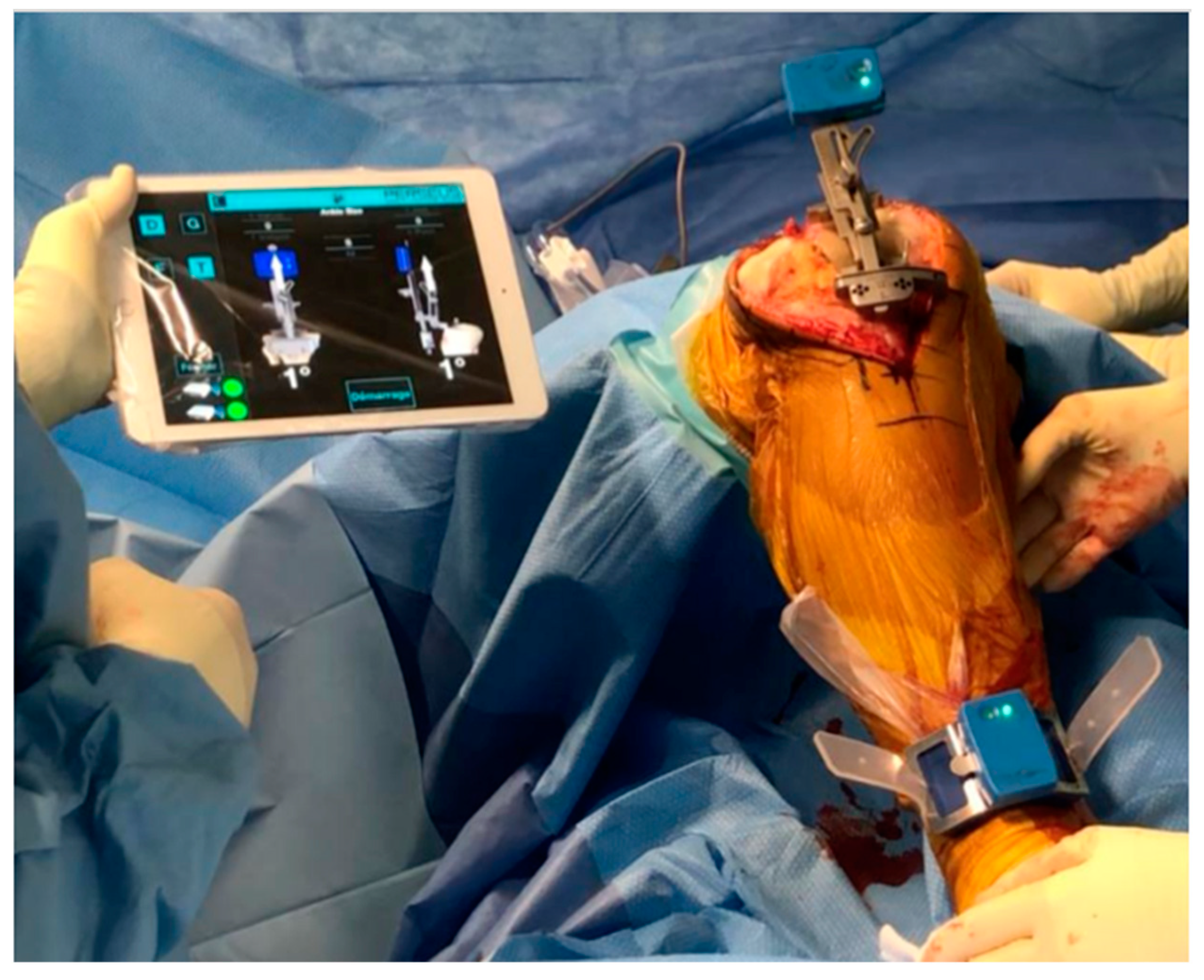 Applsci 13 02952 g001