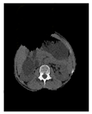 Applsci 13 03125 i003 Applsci 13 03125 i003