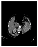 Applsci 13 03125 i012 Applsci 13 03125 i012