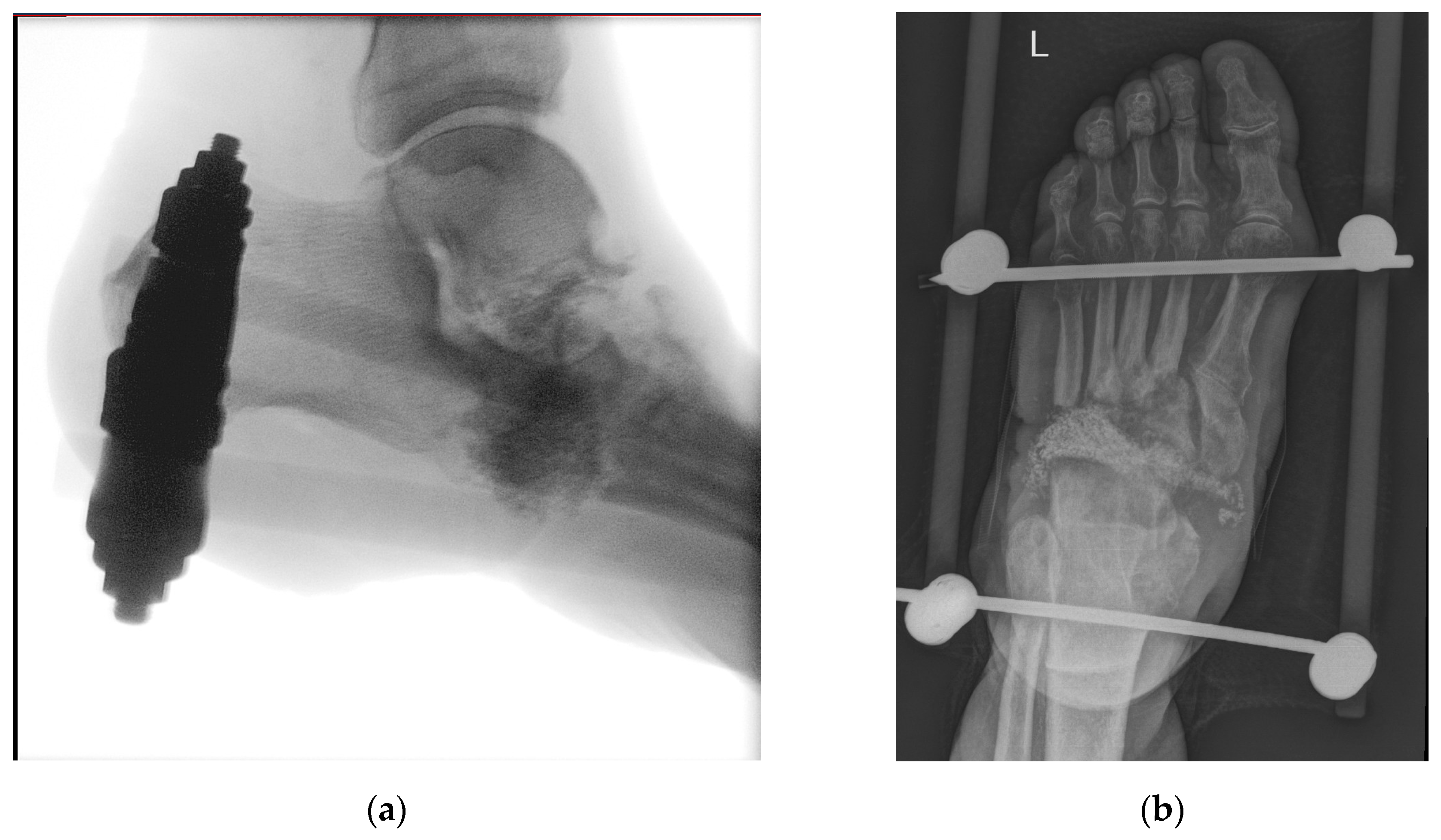 Applsci 13 03310 g002 Applsci 13 03310 g002