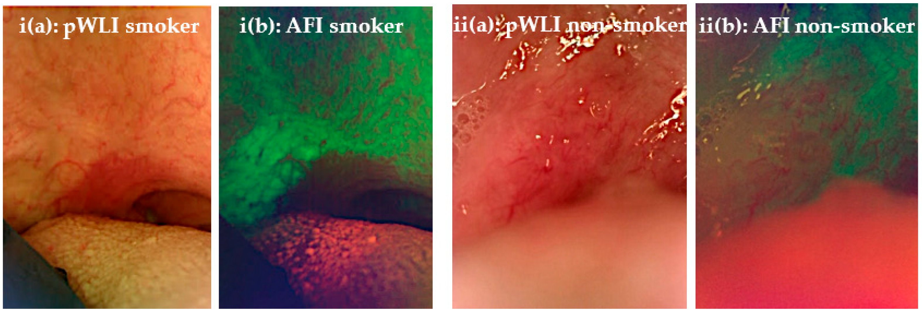 Applsci 13 03370 g004