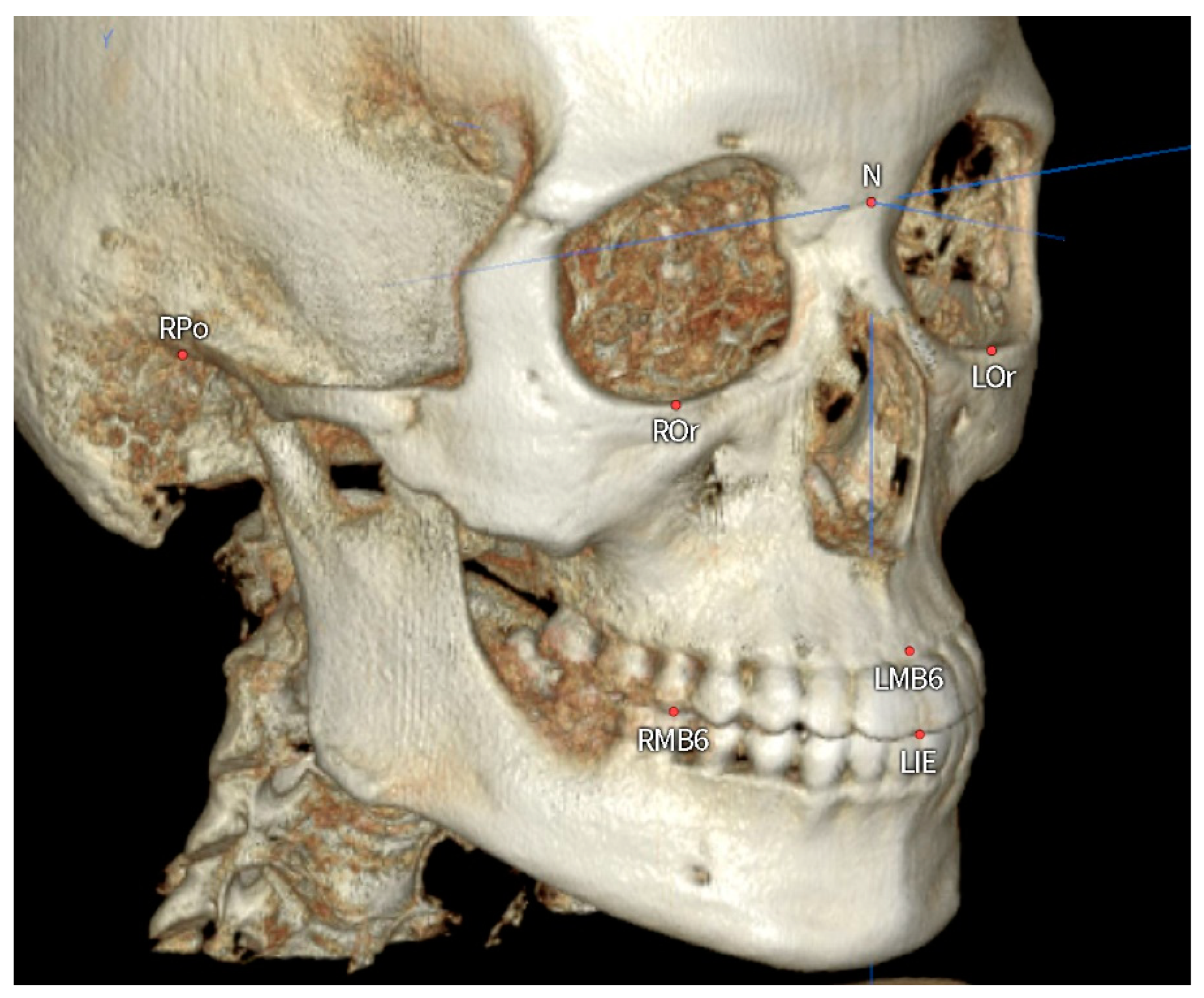 Applsci 13 03444 g001