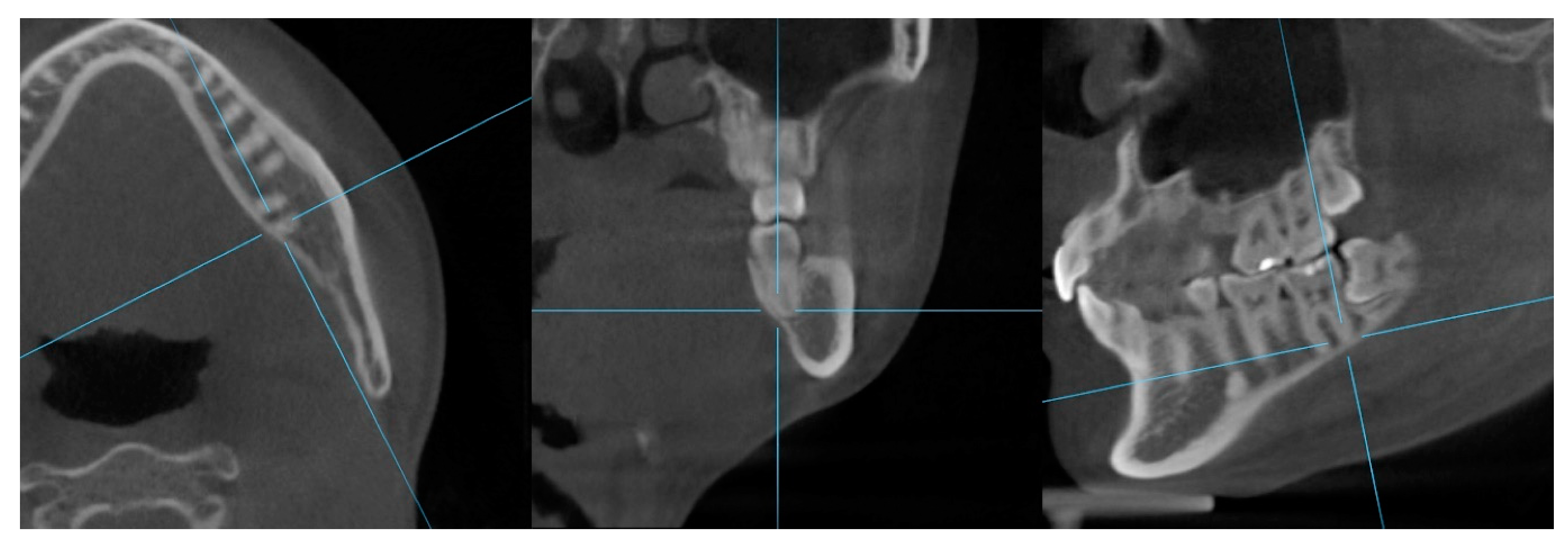 Applsci 13 03444 g004