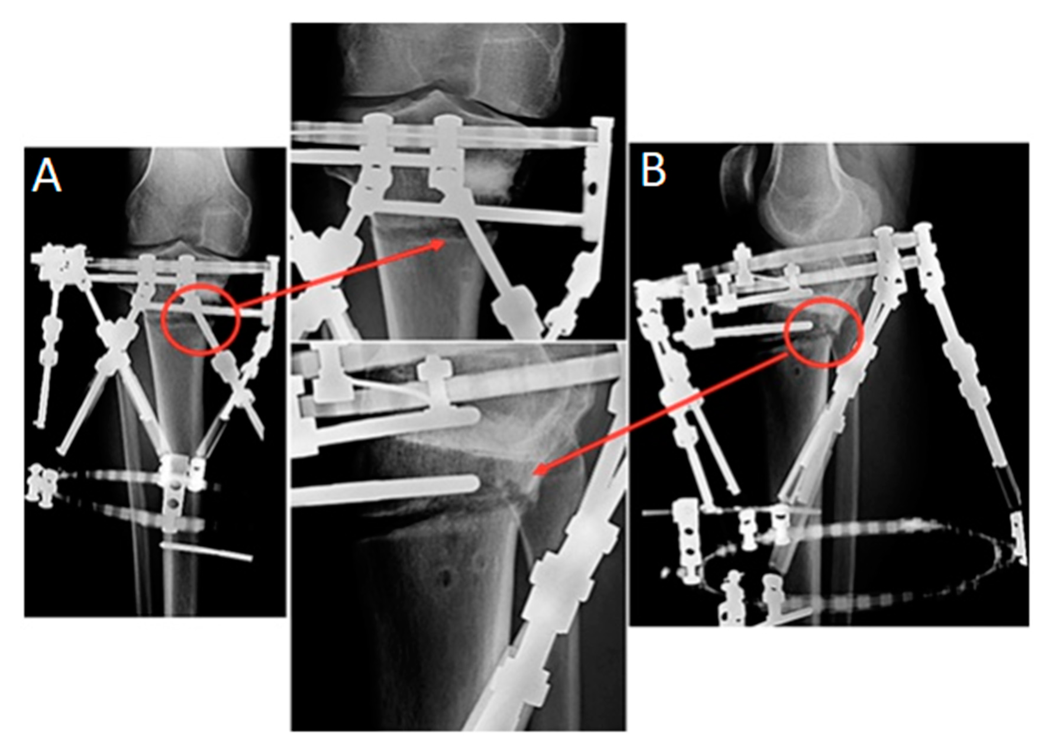 Applsci 13 03837 g003