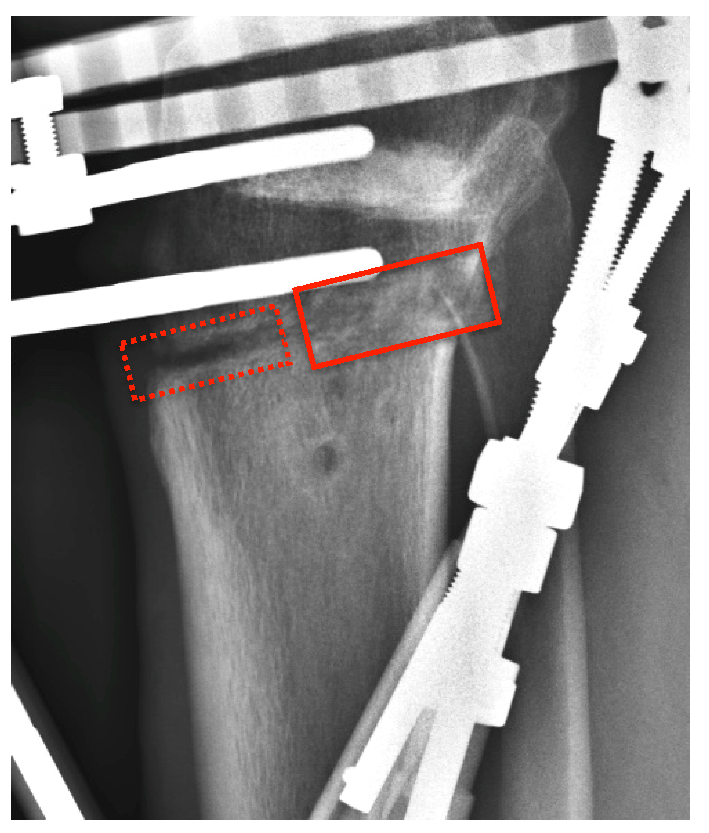 Applsci 13 03837 g004