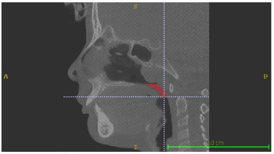 Applsci 13 03908 g001