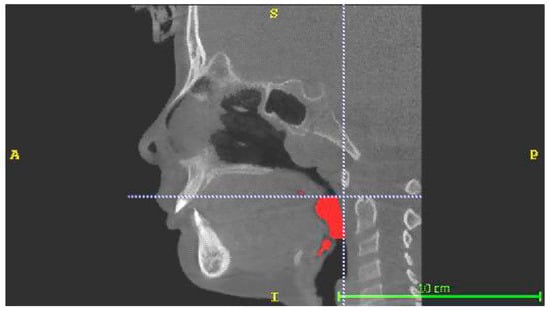 Applsci 13 03908 g002