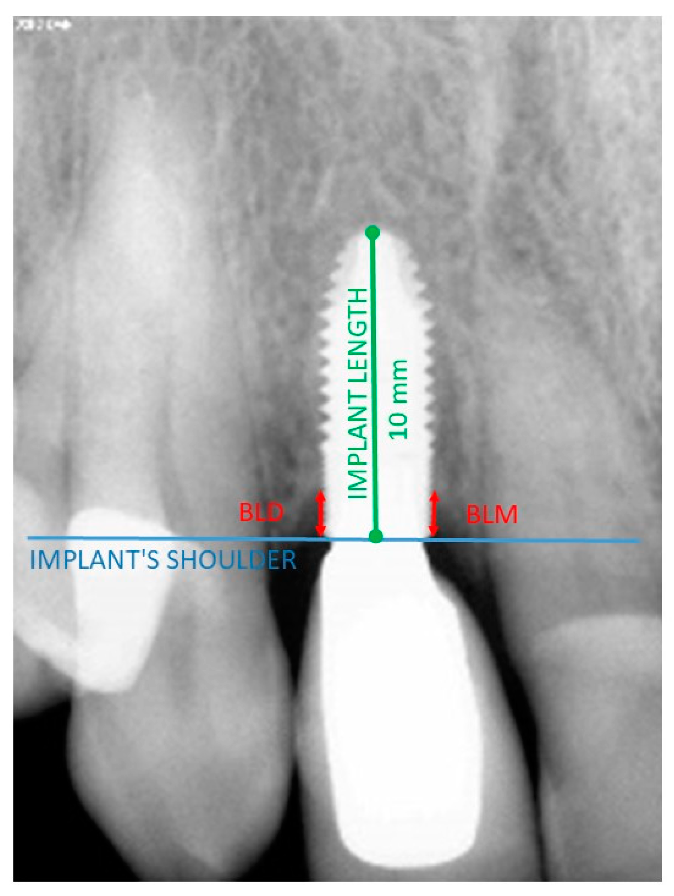 Applsci 13 03936 g002