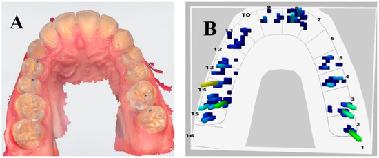 Applsci 13 04335 g003