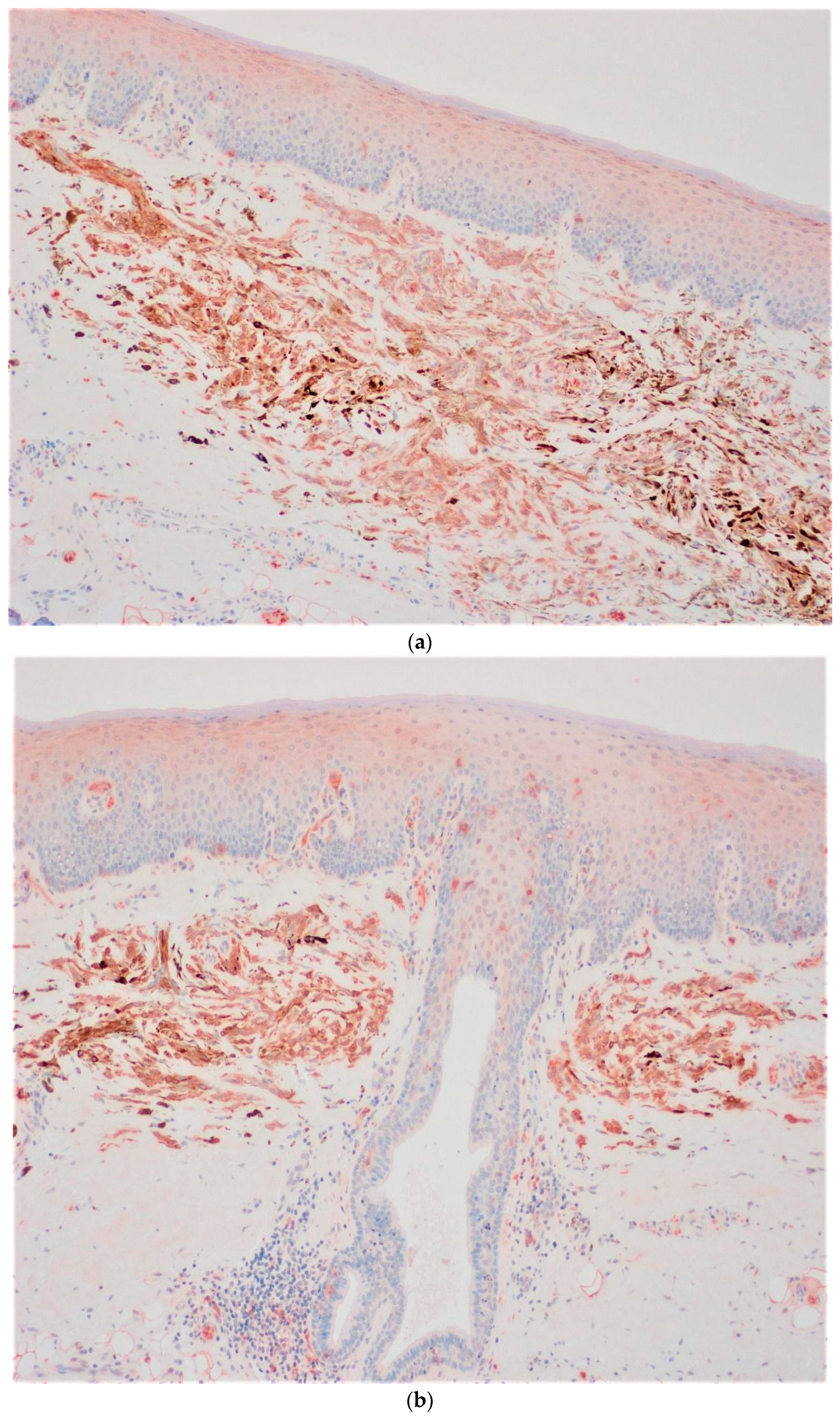 Applsci 13 04420 g004