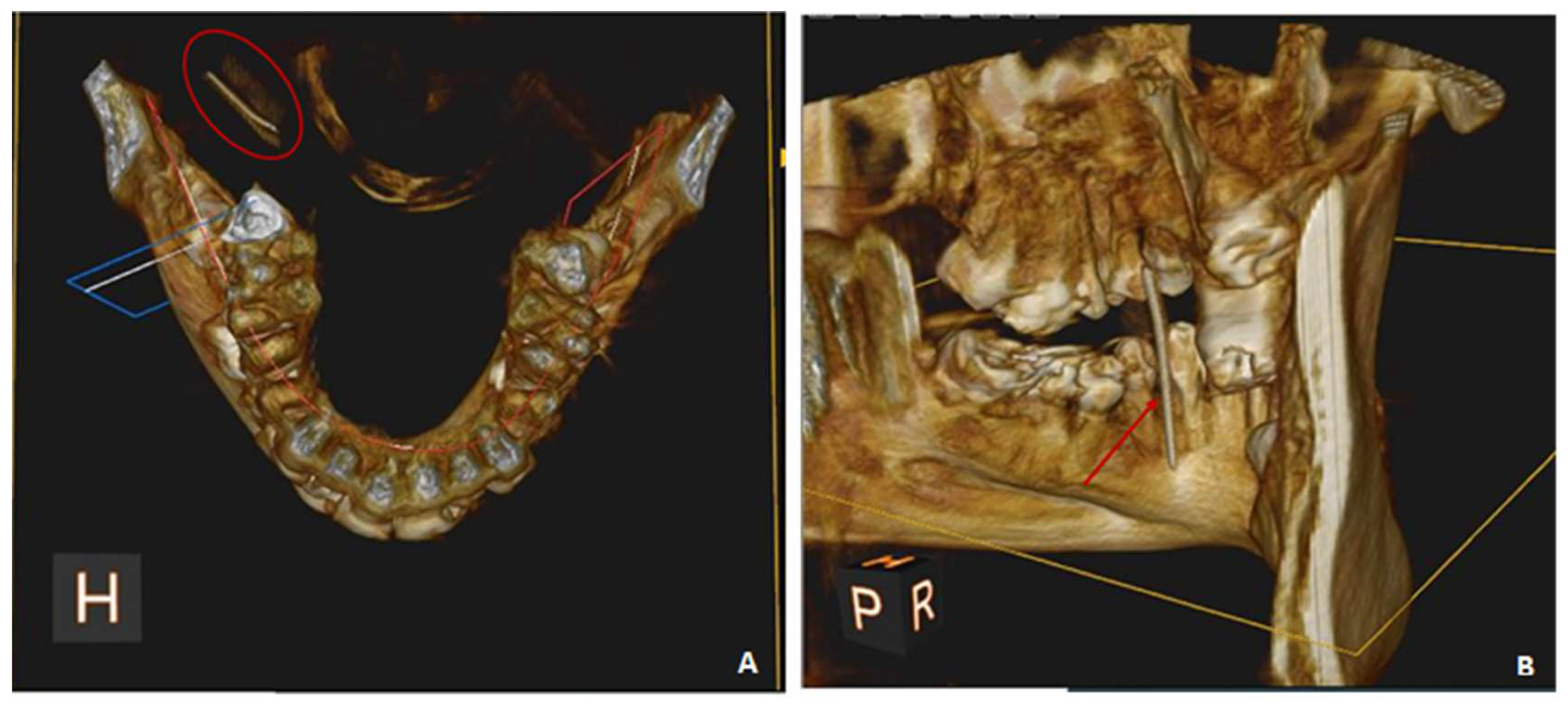 Applsci 13 04421 g004