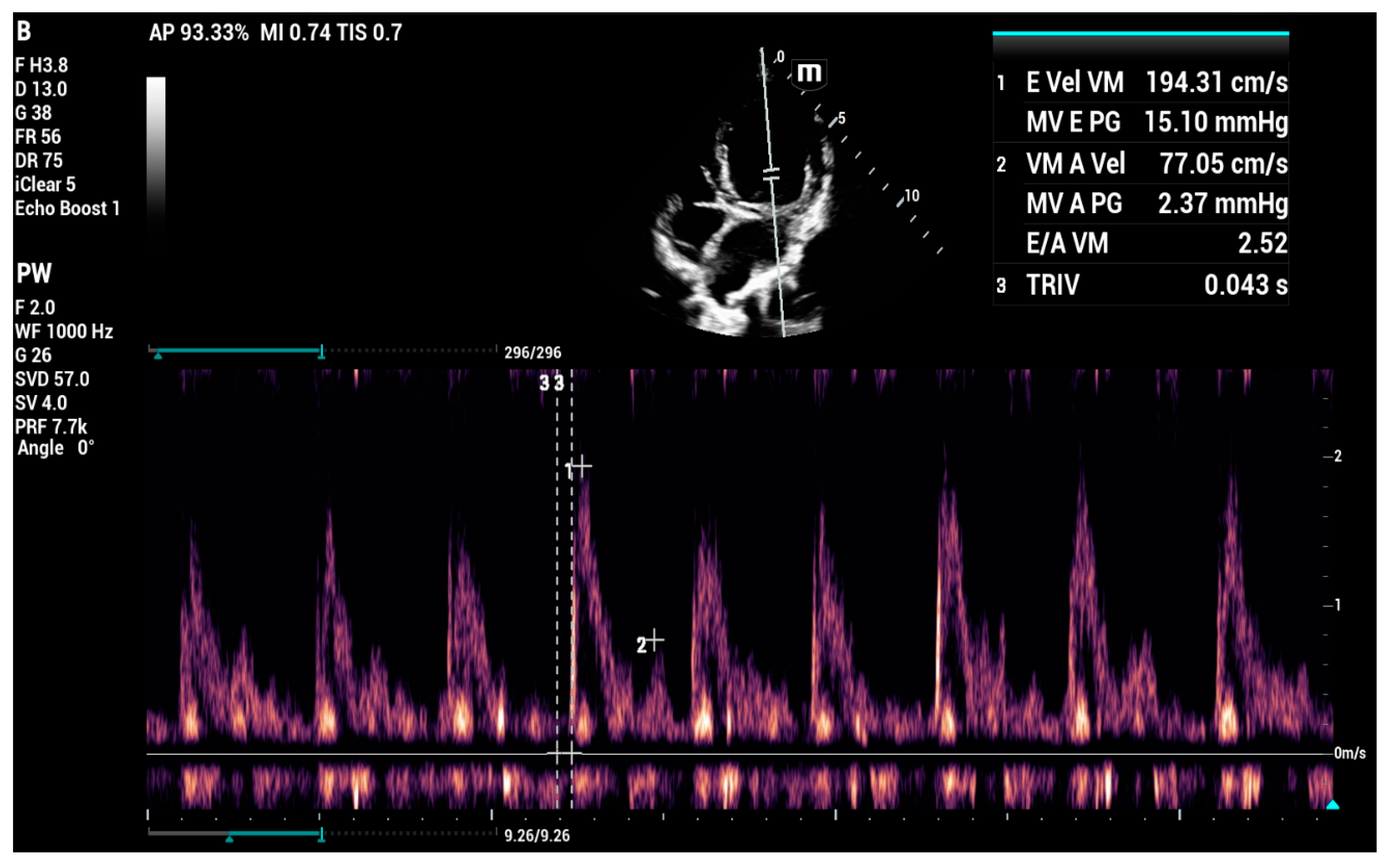 Applsci 13 04437 g011