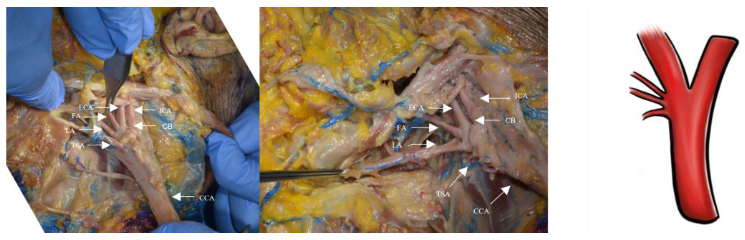 Applsci 13 04737 g005