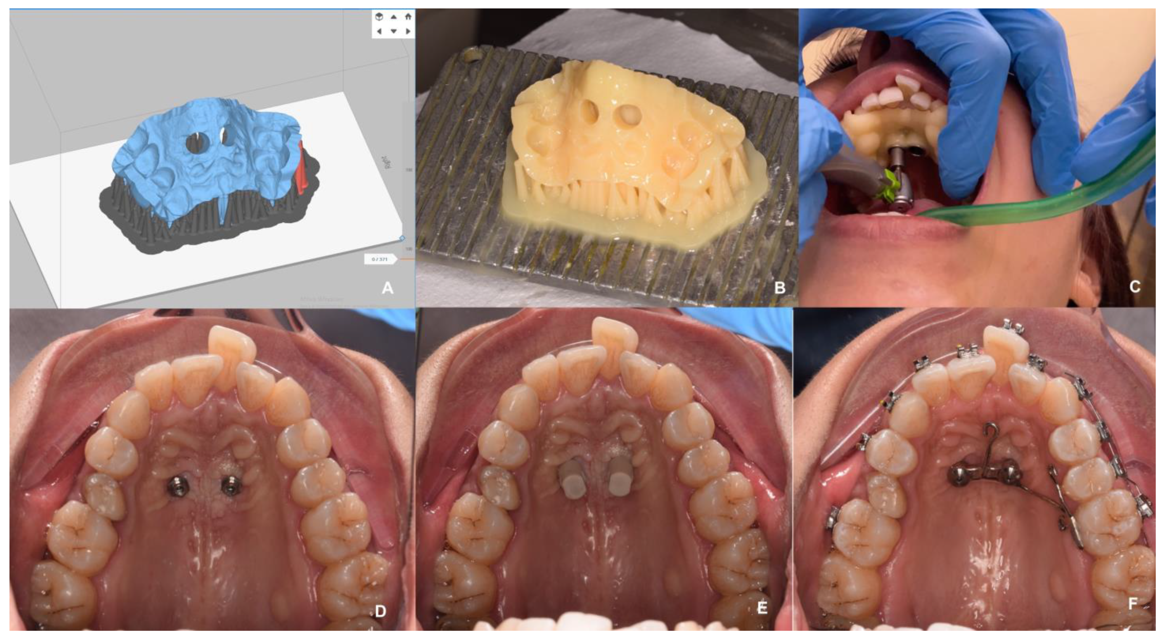Applsci 13 04986 g014 Applsci 13 04986 g014