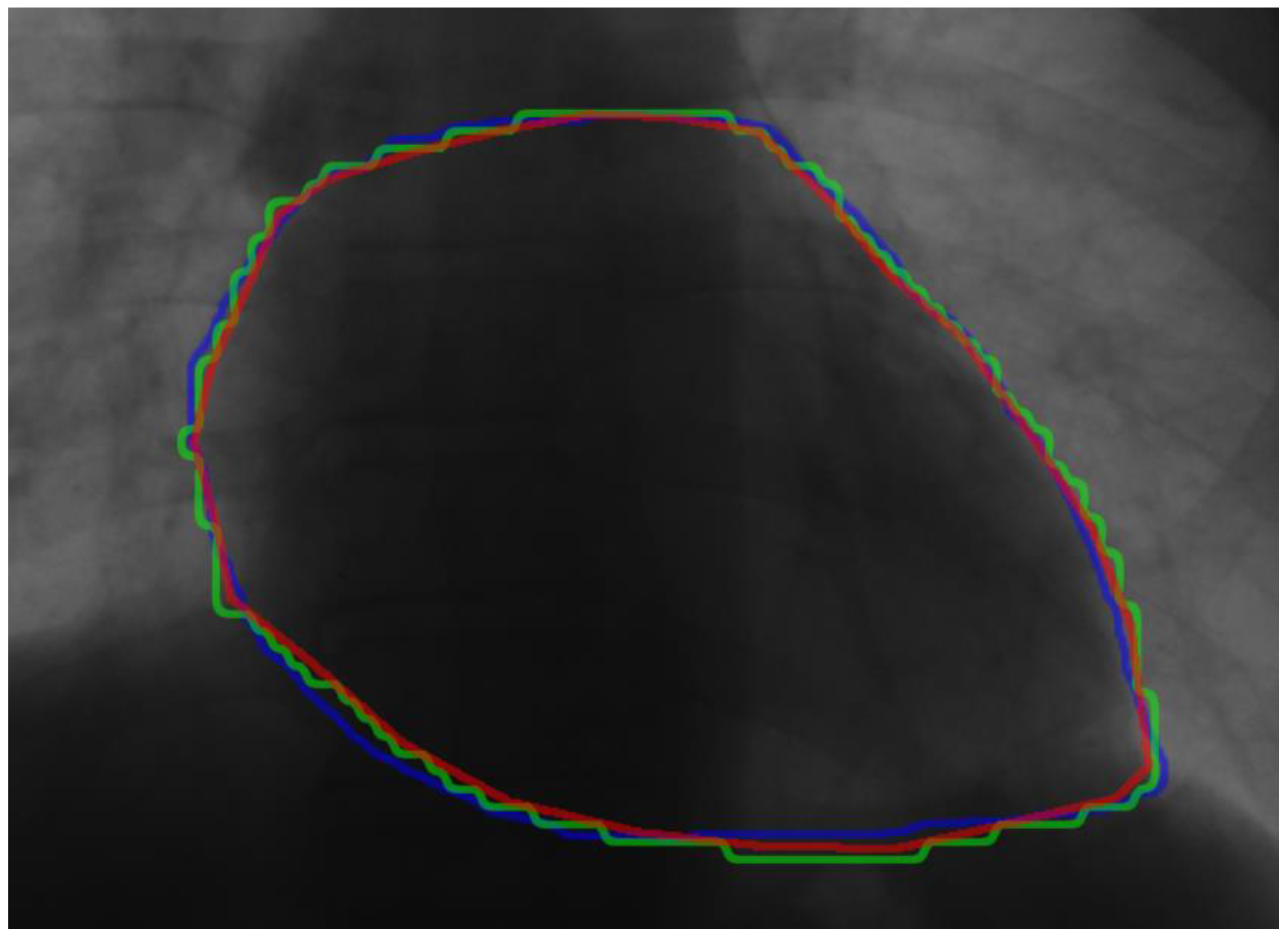 Applsci 13 05000 g012