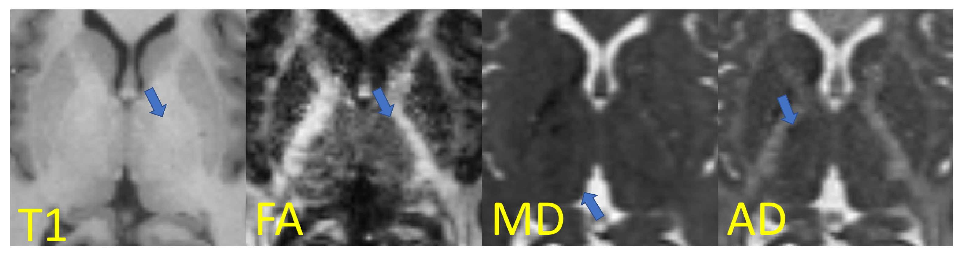 Applsci 13 05284 g003