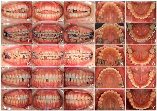 Applsci 13 05464 g008