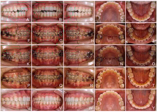 Applsci 13 05464 g010