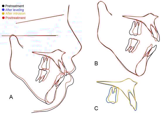 Applsci 13 05464 g011
