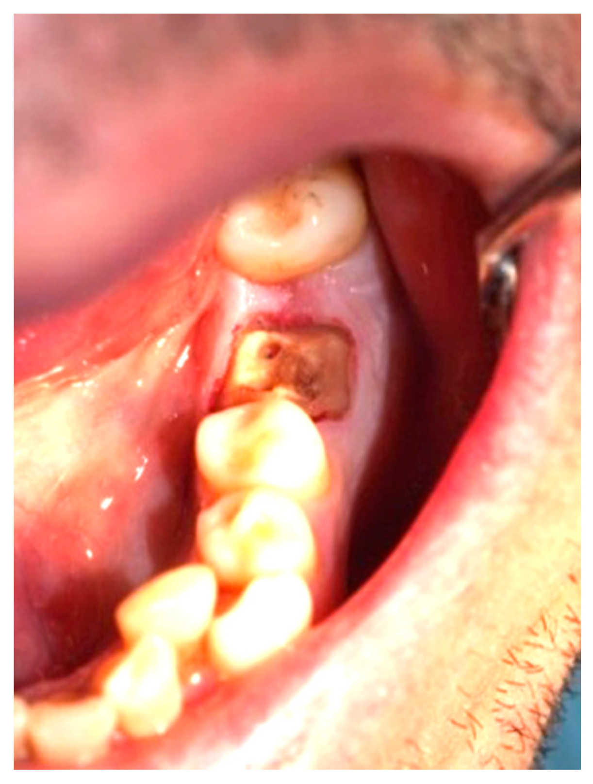 Applsci 13 05527 g003