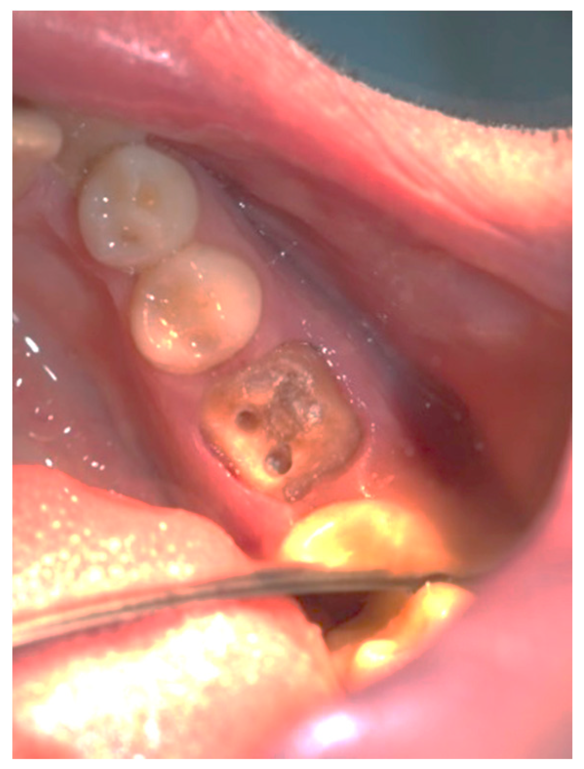 Applsci 13 05527 g005