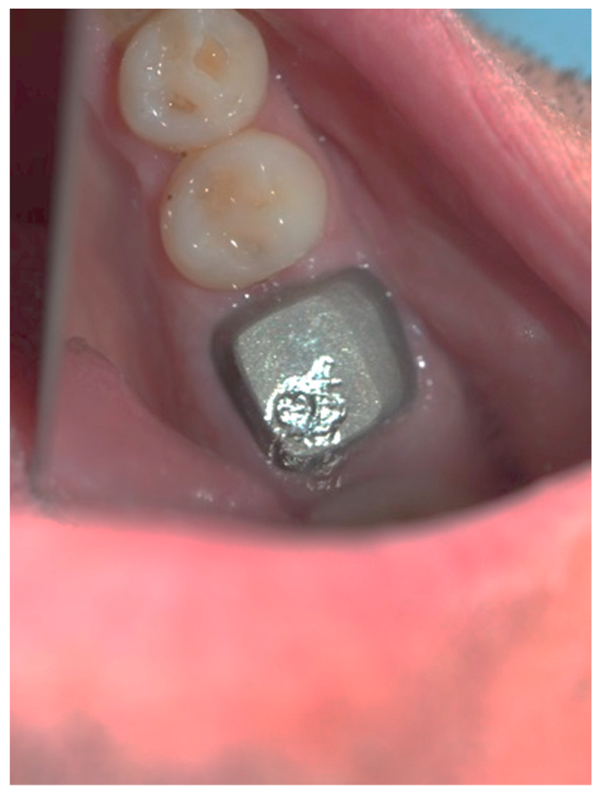 Applsci 13 05527 g007