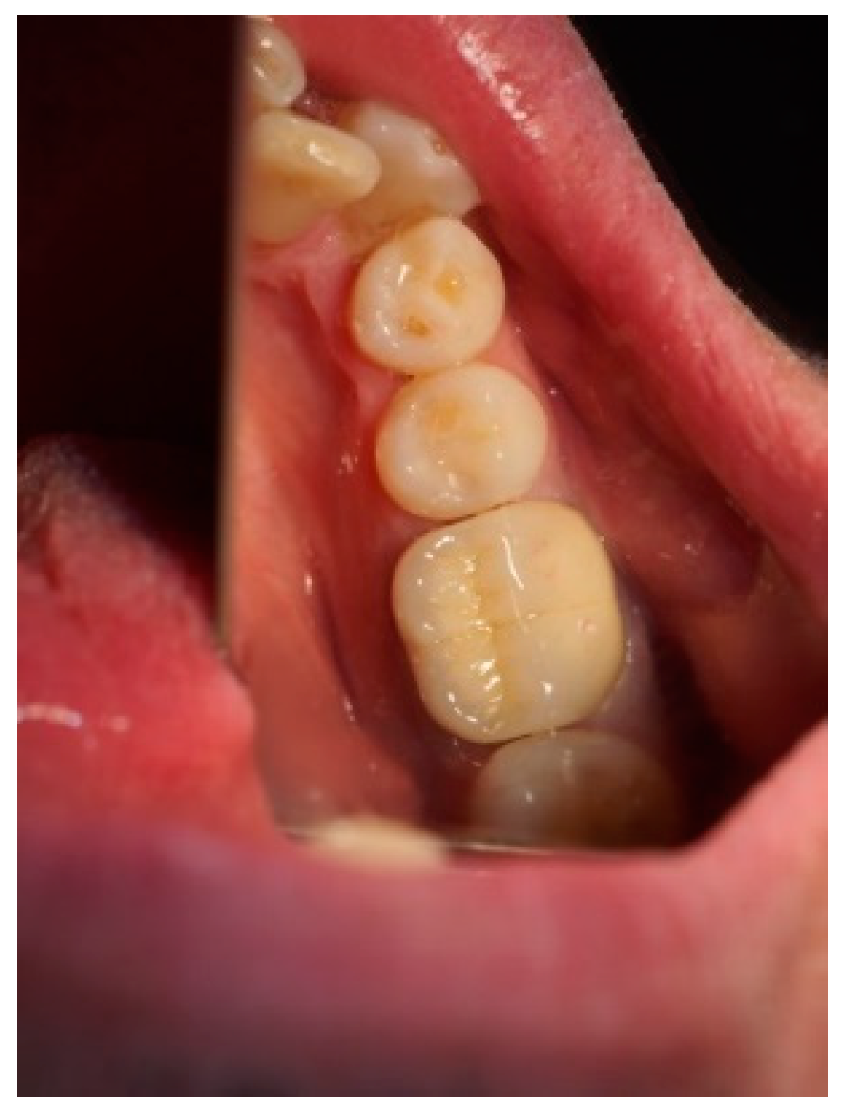 Applsci 13 05527 g008