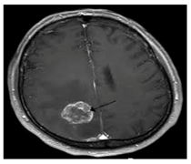 Applsci 13 06132 i002