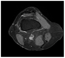 Applsci 13 06132 i005