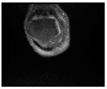 Applsci 13 06132 i006