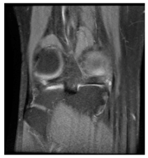 Applsci 13 06132 i007