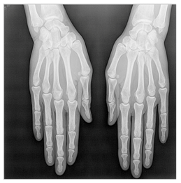 Applsci 13 06132 i039