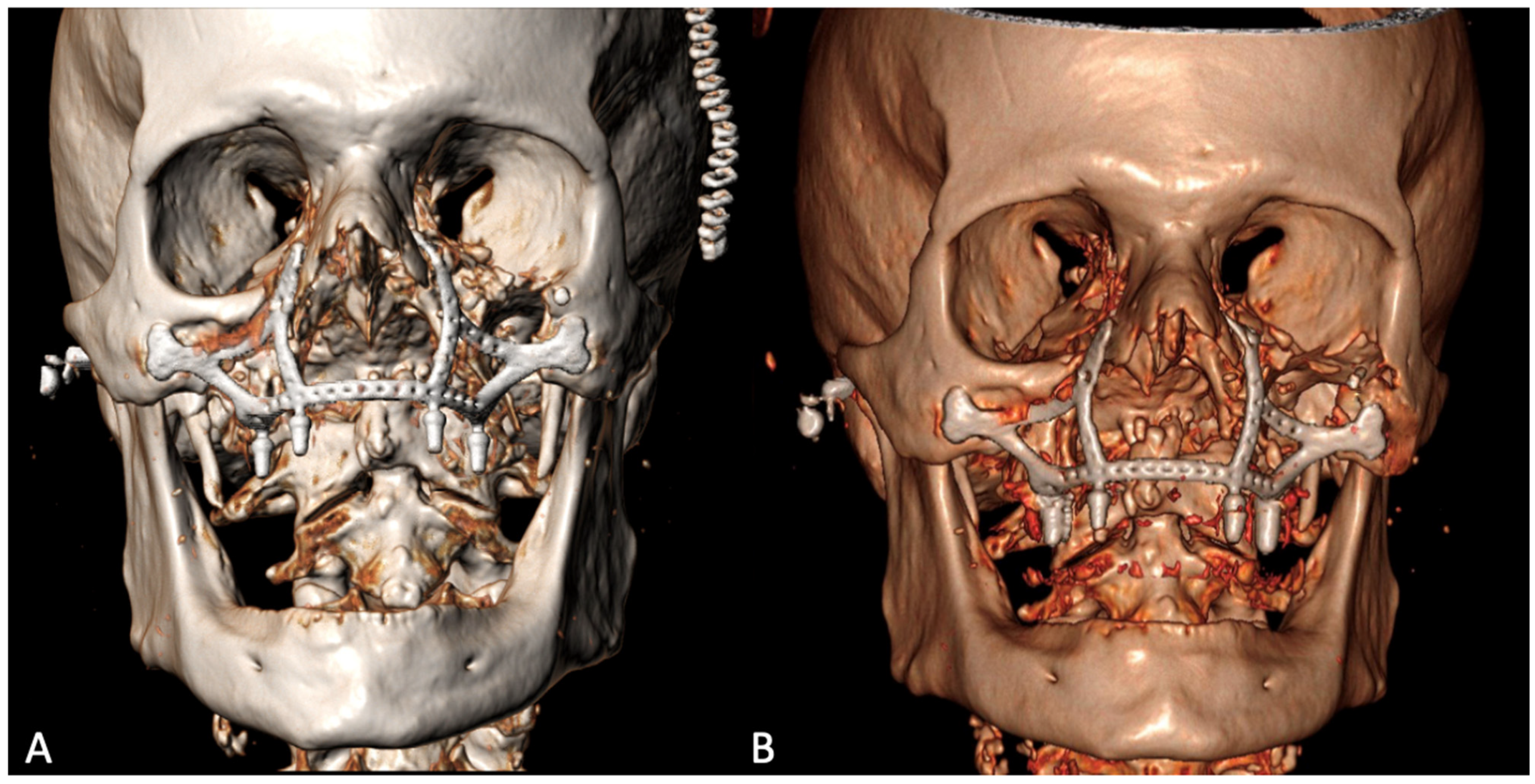 Applsci 13 06269 g006