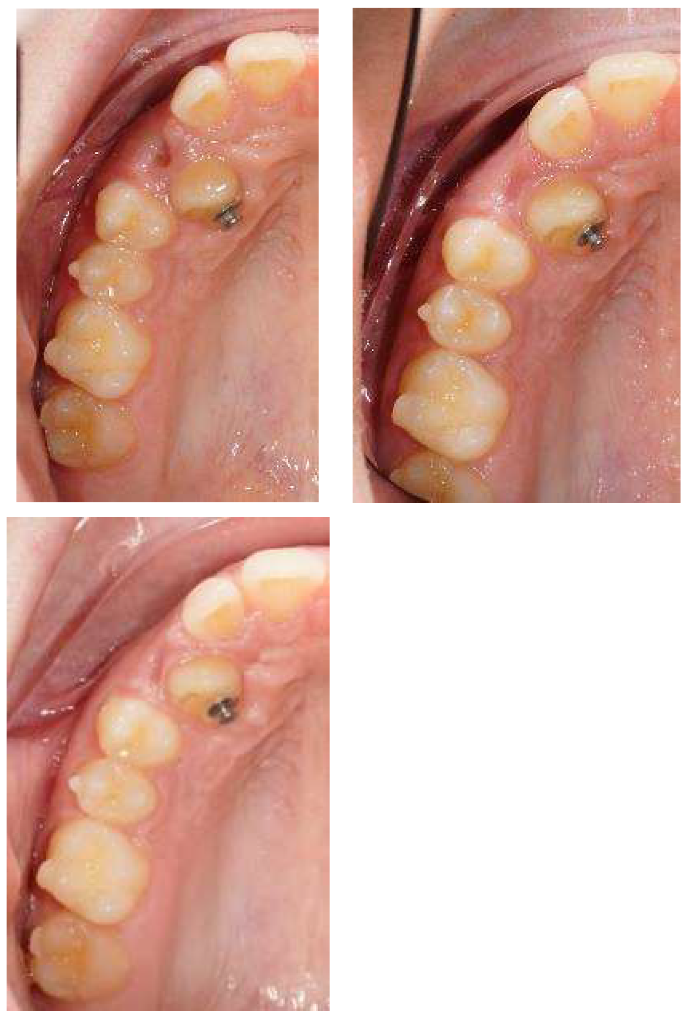 Applsci 13 06914 g006 Applsci 13 06914 g006