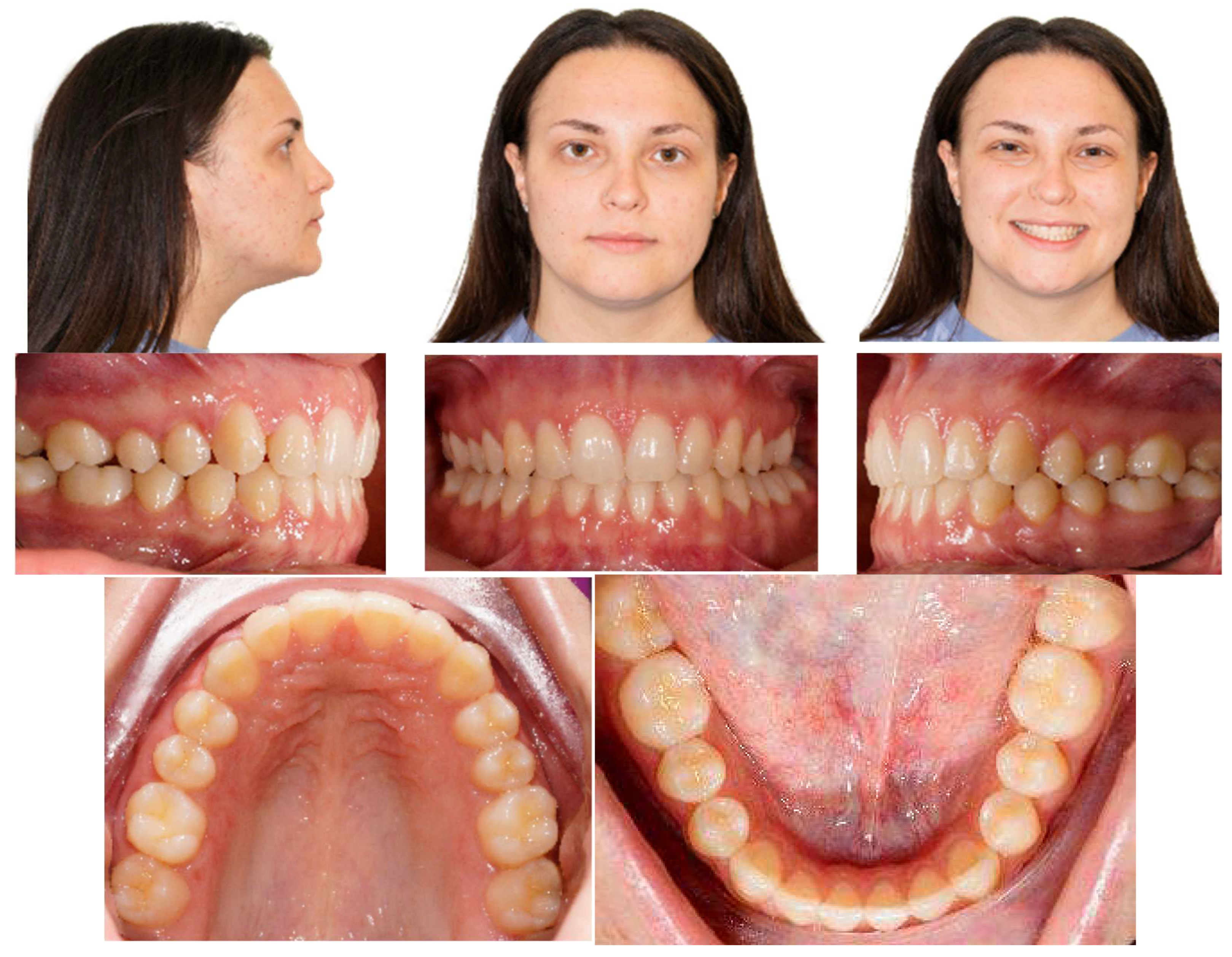 Applsci 13 06914 g009 Applsci 13 06914 g009