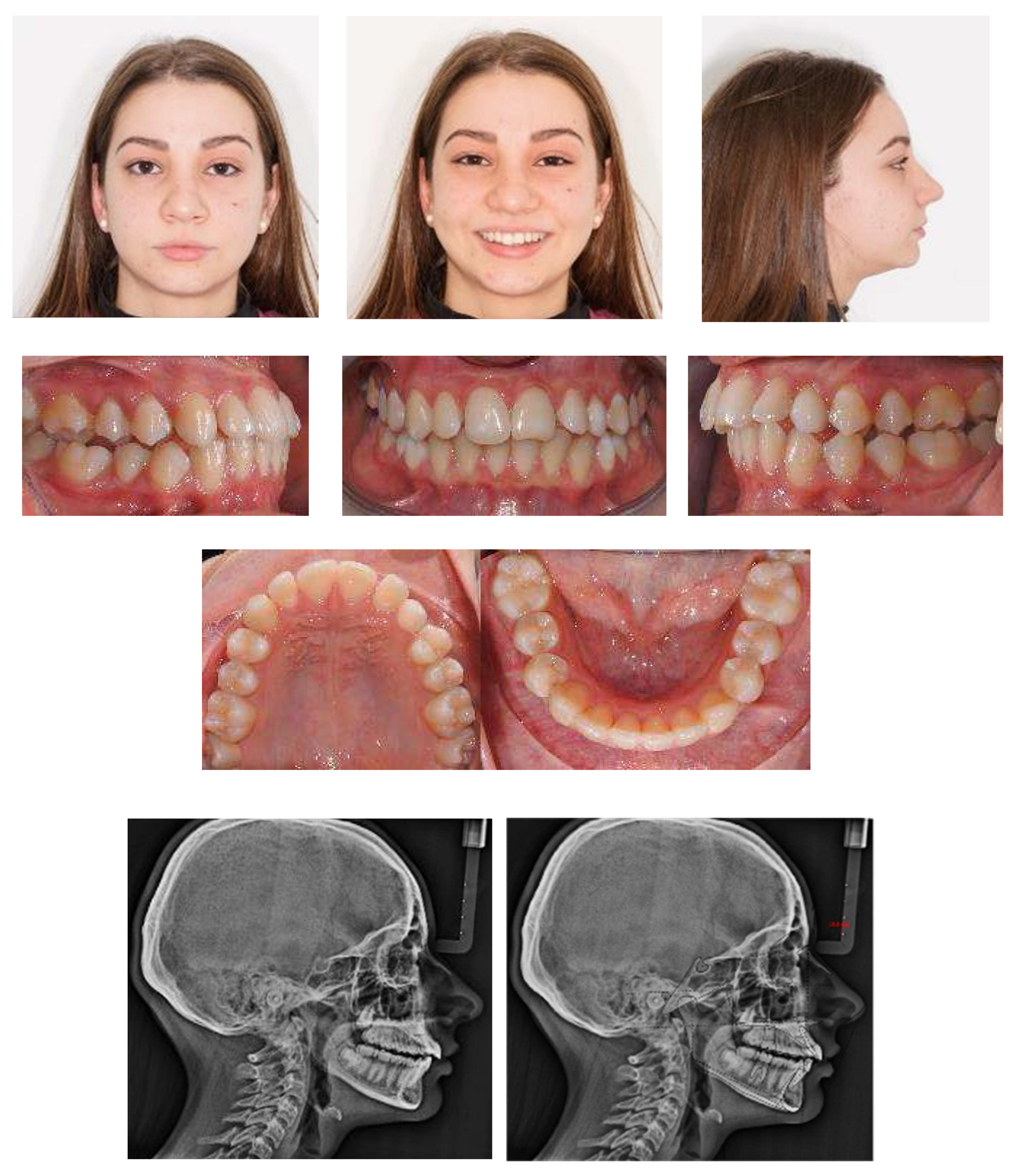 Applsci 13 06914 g011a Applsci 13 06914 g011a