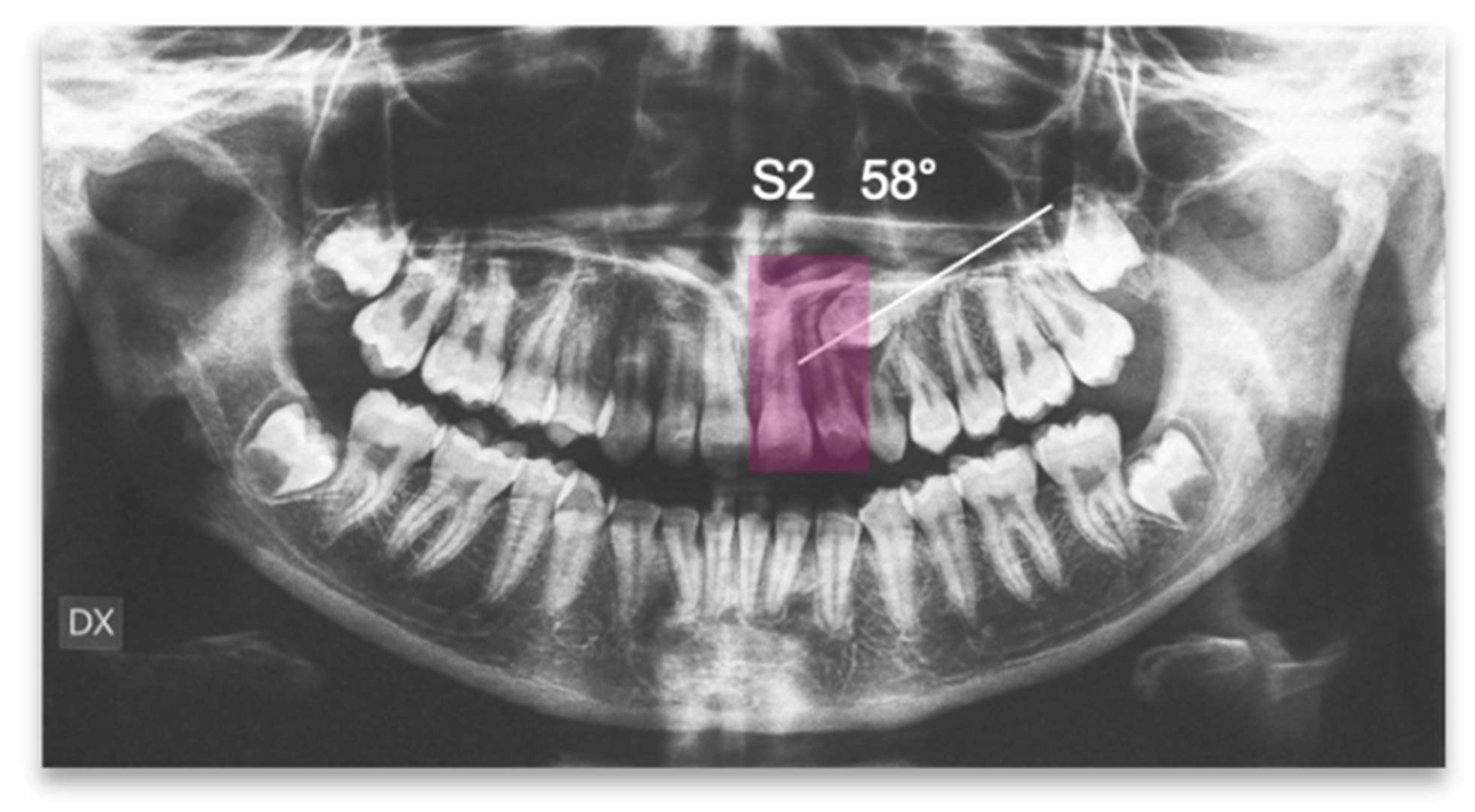 Applsci 13 06914 g012 Applsci 13 06914 g012