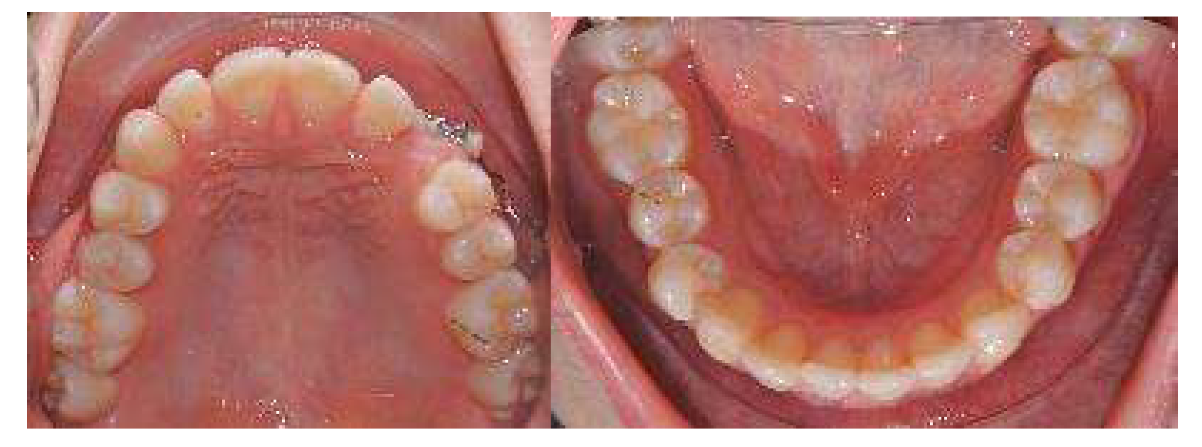 Applsci 13 06914 g013b Applsci 13 06914 g013b