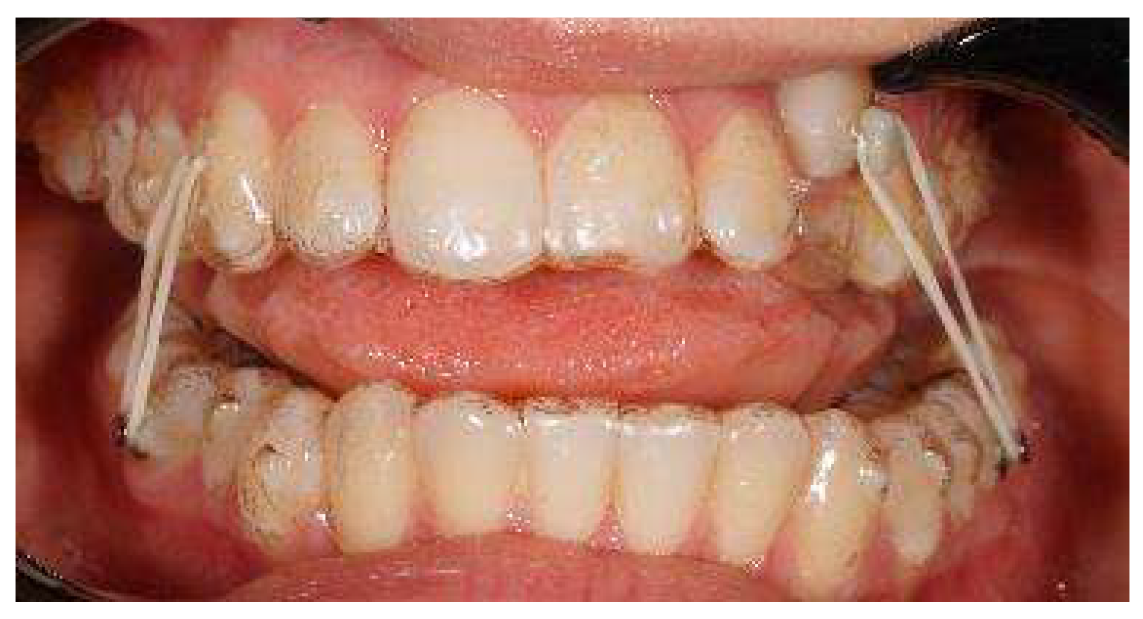 Applsci 13 06914 g014b Applsci 13 06914 g014b