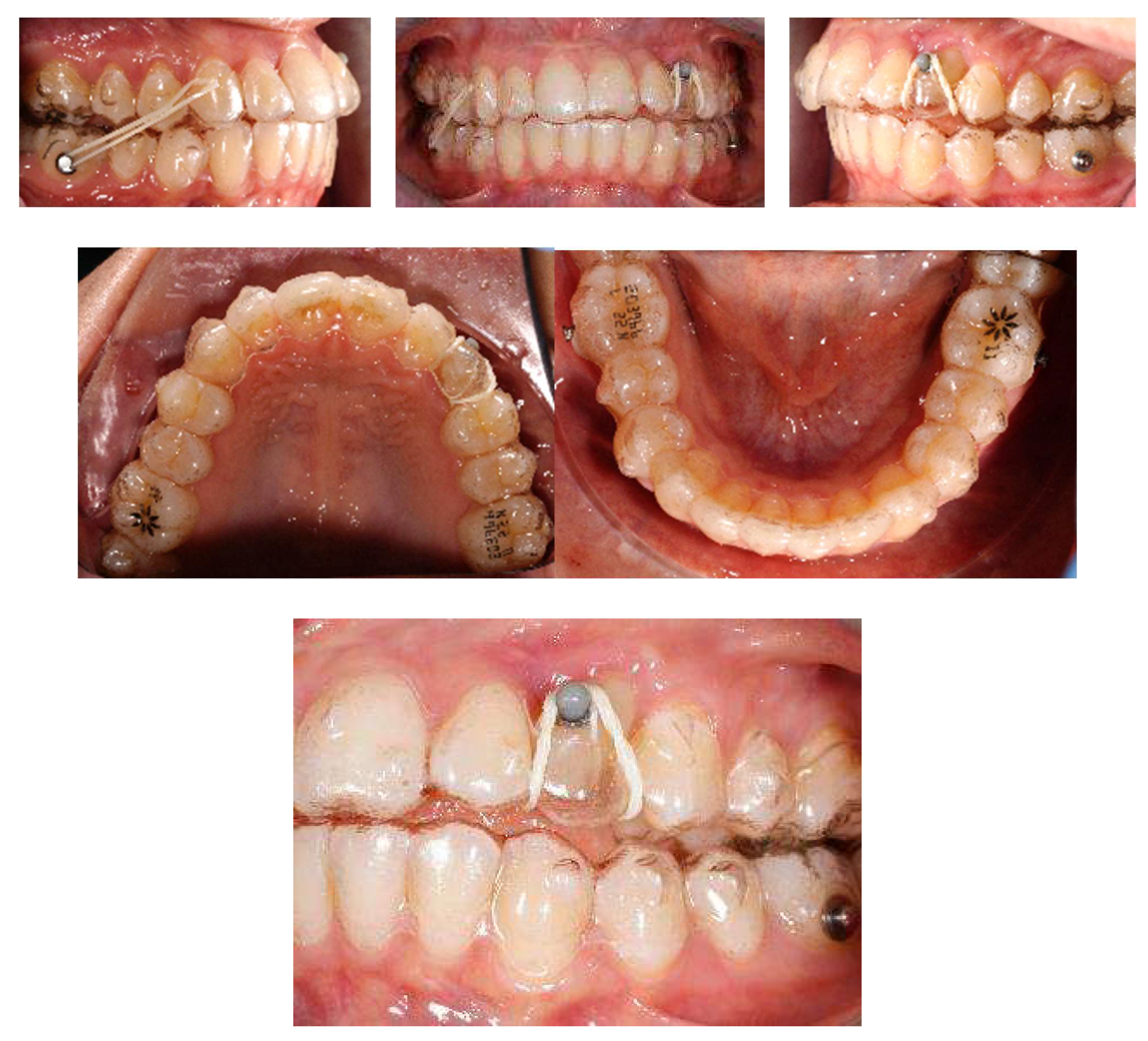 Applsci 13 06914 g015 Applsci 13 06914 g015