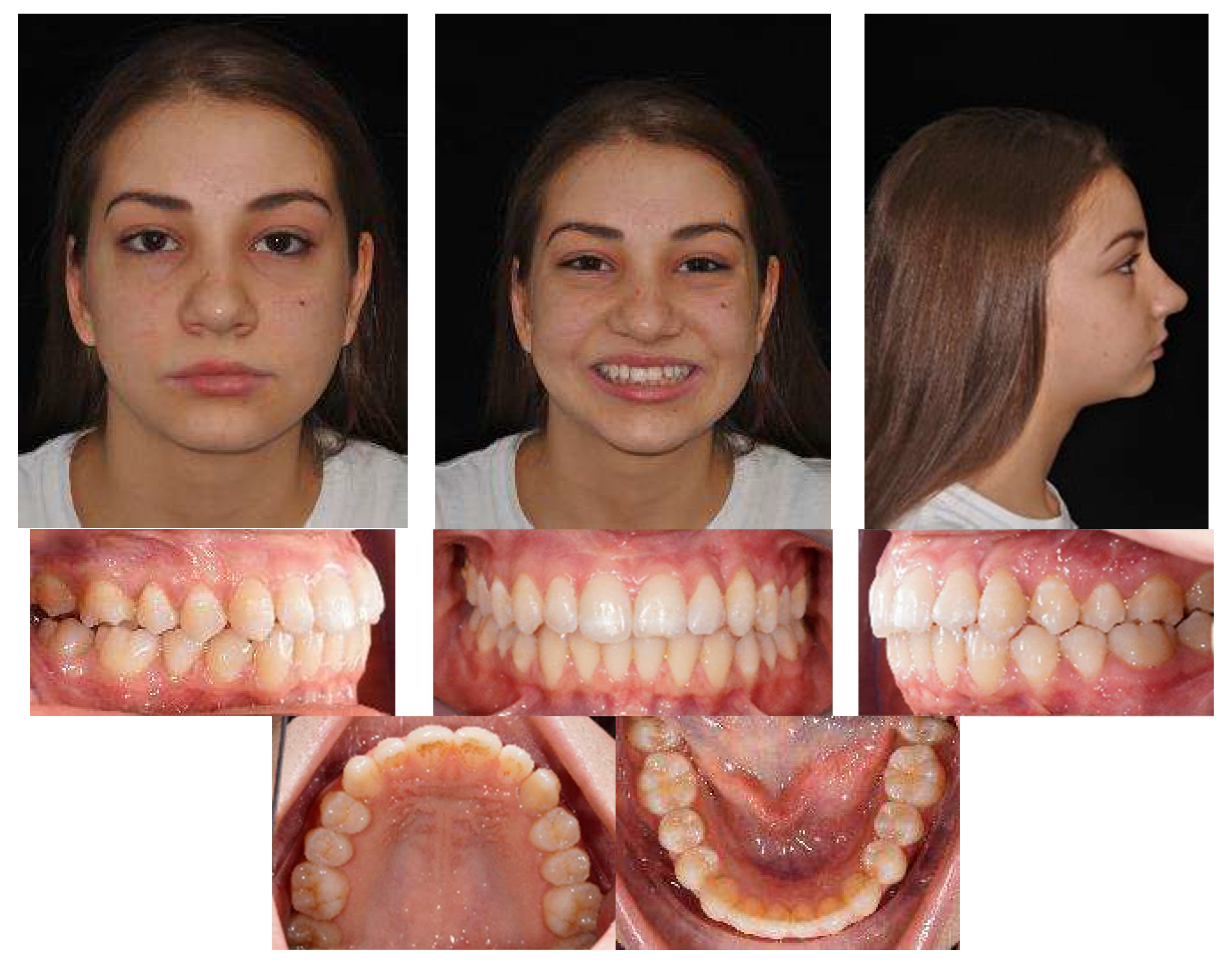 Applsci 13 06914 g017 Applsci 13 06914 g017