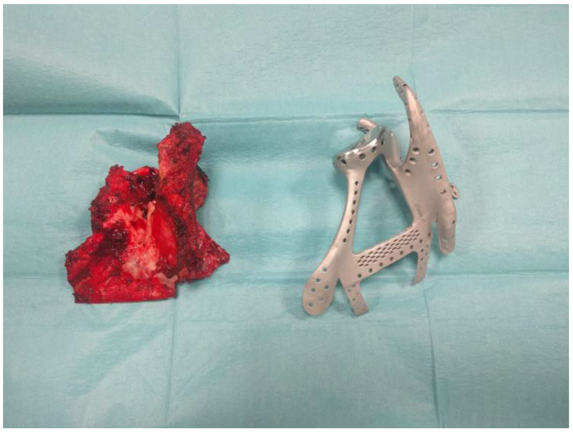 Applsci 13 07056 g006 Applsci 13 07056 g006