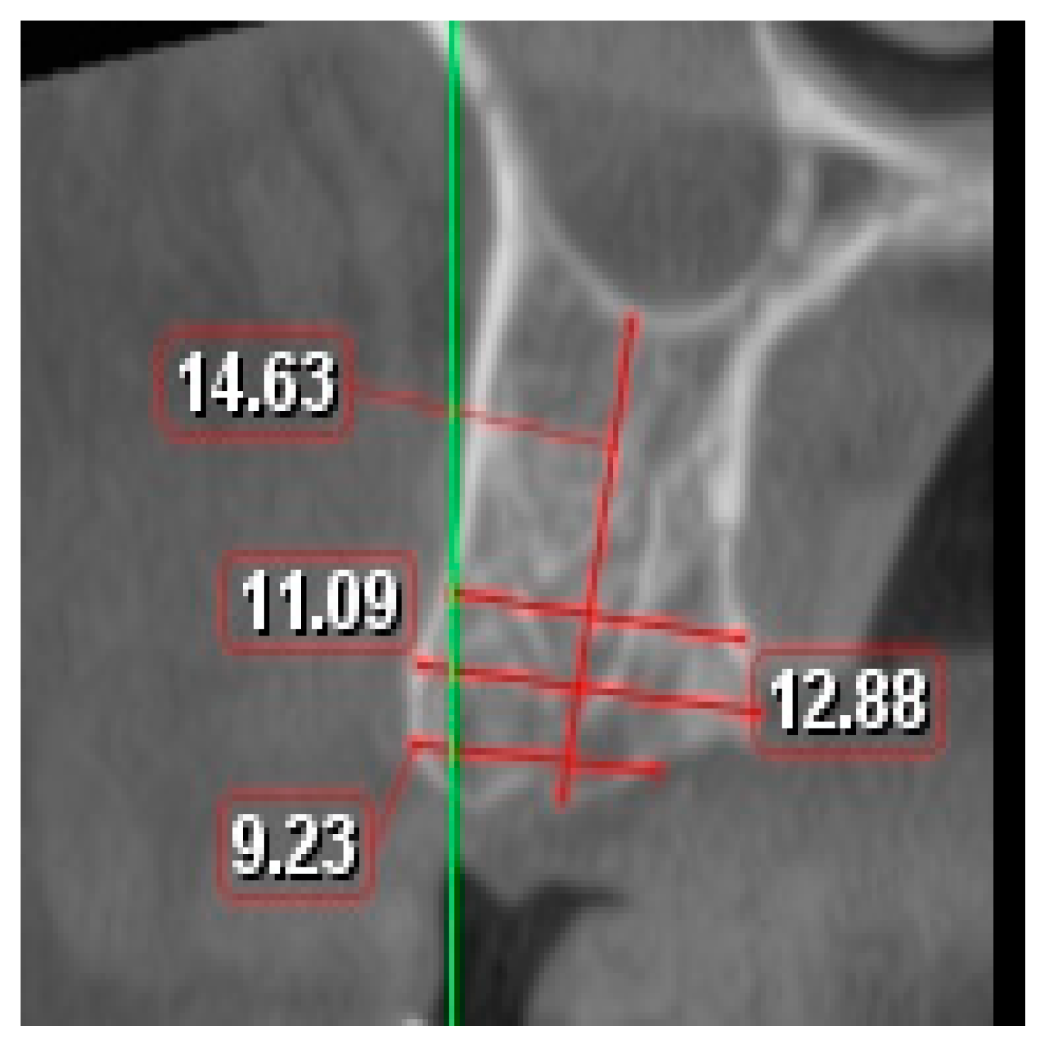 Applsci 13 07076 g001 Applsci 13 07076 g001
