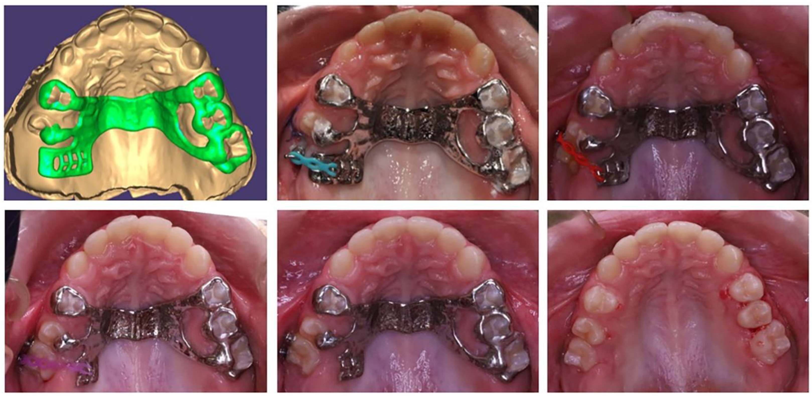 Applsci 13 07353 g004 Applsci 13 07353 g004