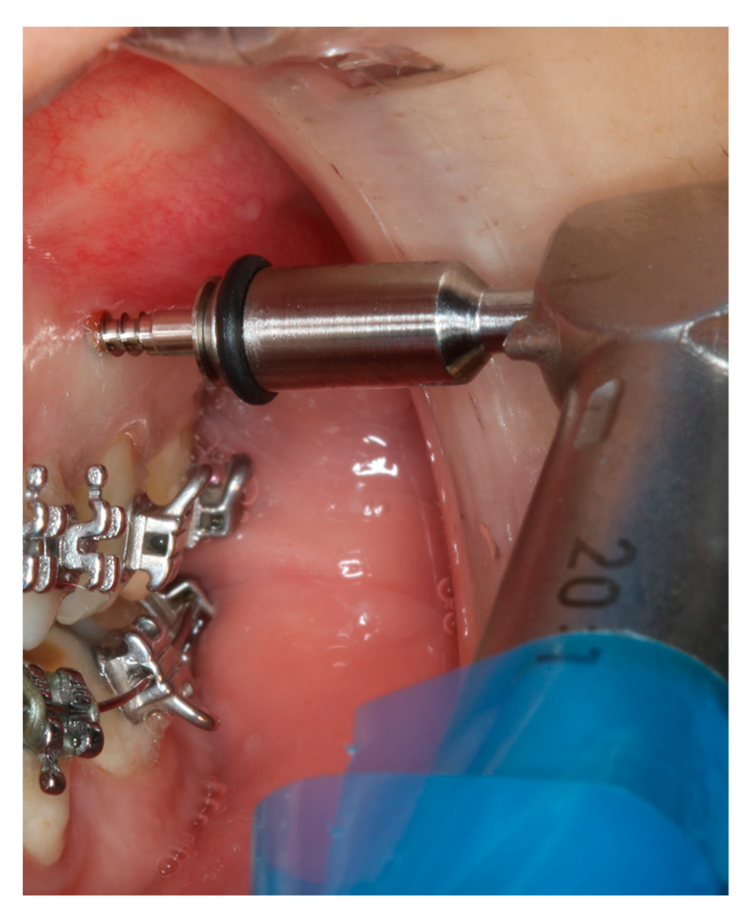 Applsci 13 08167 g002