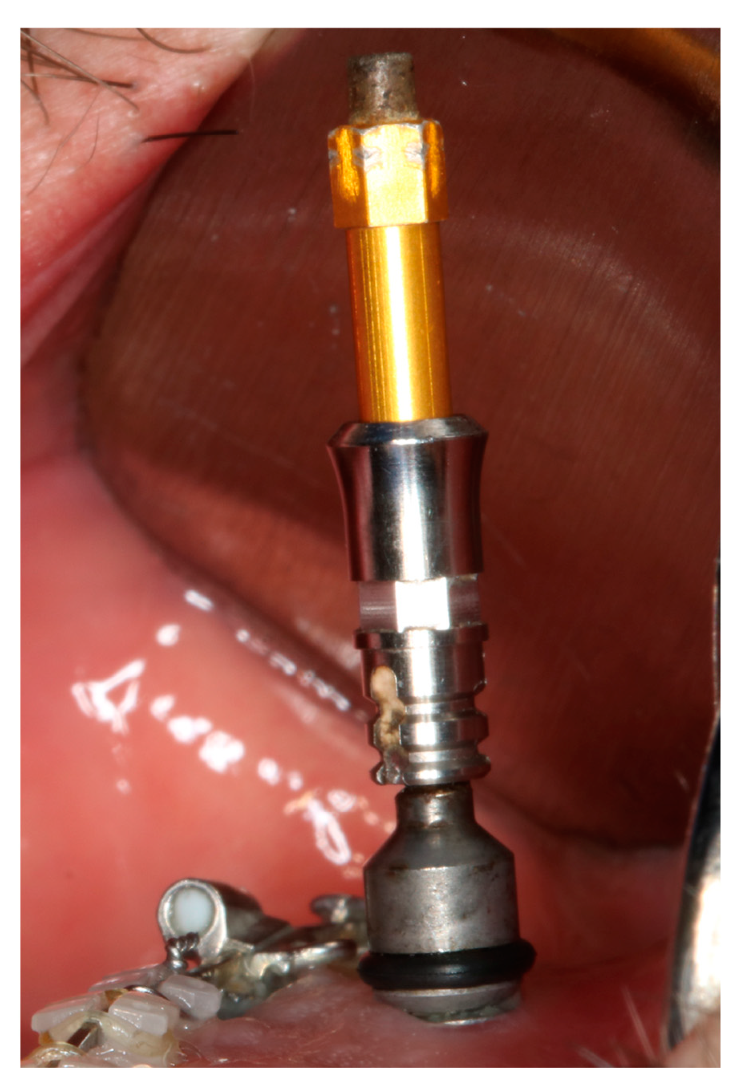 Applsci 13 08167 g004